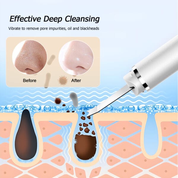 pore extractor blackhead remover tools face spatula blackhead remover skin spatula pore scraper for face skin scrubber face spatula blackhead spatula skin scrubber face spatula blackheads removal for nose pore spatula nose scraper for blackheads pore cleaner tool pore cleaner blackhead spatula tool nose pore cleaner