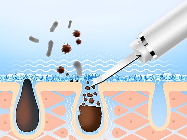 Skin Scrubber Face Spatula Blackhead Remover Pore Cleaner Refresh Your Glow Sip Your Calm Refresh Your Glow Sip Your Calm pore extractor blackhead remover tools face spatula blackhead remover skin spatula pore scraper for face skin scrubber face spatula blackhead spatula skin scrubber face spatula blackheads removal for nose pore spatula nose scraper for blackheads pore cleaner tool pore cleaner blackhead spatula tool nose pore cleaner